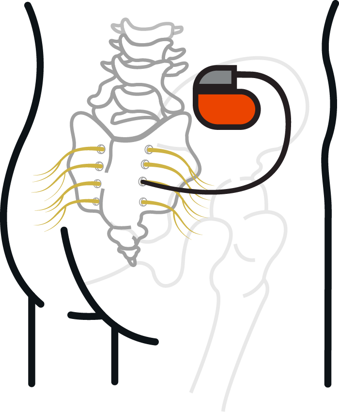 BOOM-IBD_CLINICAL_TRIAL_GRAPHIC04